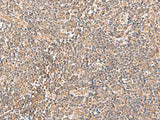 Immunohistochemistry of paraffin-embedded Human tonsil tissue using TRUB1 Polyclonal Antibody at dilution of 1:70(×200)