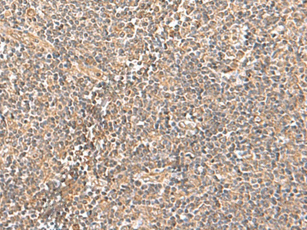 Immunohistochemistry of paraffin-embedded Human tonsil tissue using TRUB1 Polyclonal Antibody at dilution of 1:70(×200)