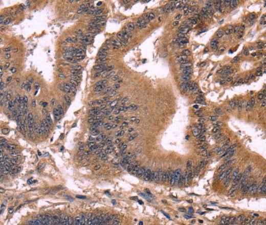 Anti-Human/Mouse CCDC106 Antibody