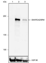 Anti-Human/Rat/Mouse SMARCA2/BRM Antibody [A624]