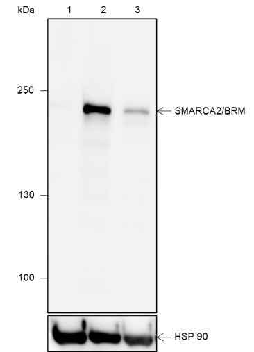 Anti-Human/Rat/Mouse SMARCA2/BRM Antibody [A624]