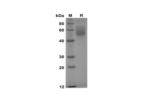 SDS-PAGE analysis of Rat Serpin A6/CBG proteins, 2 μg/lane of Recombinant Rat Serpin A6/CBG proteins was resolved with SDS-PAGE under reducing conditions, showing bands at 50-70 kDa.