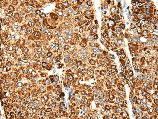 Anti-Human/Mouse/Rat CACNG5 Antibody
