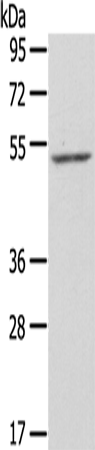 Anti-Human/Mouse ZFP36L2 Antibody - ABMIUM