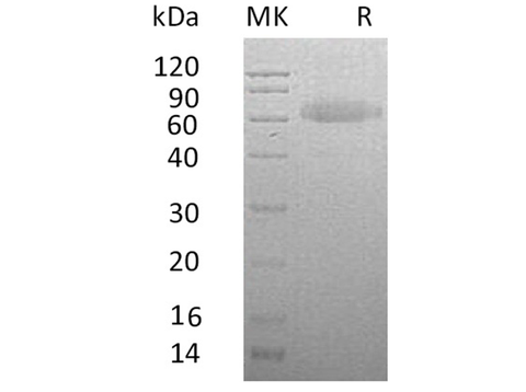 Recombinant Human RSPO3 Protein (Fc & His Tag) - ABMIUM