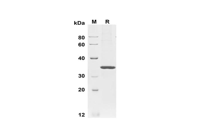 SDS-PAGE analysis of Human Kallikrein 3/PSA proteins, 2 μg/lane of Recombinant Human Kallikrein 3/PSA proteins was resolved with SDS-PAGE under reducing conditions, showing bands at 35 kDa.