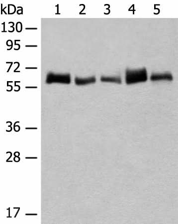 Western blot analysis of K562 and A172 cell Human bladder transitional cell carcinoma grade 2-3 tissue NIH/3T3 cell Mouse liver tissue lysates using CCDC47 Polyclonal Antibody at dilution of 1:300