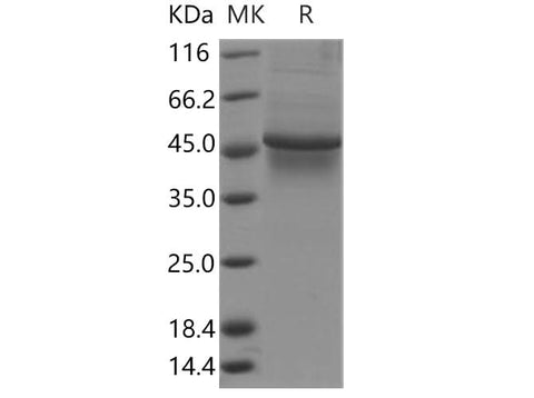 Recombinant Human TAPBP/ Tapasin Protein (His Tag) - ABMIUM