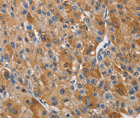 Anti-Human KLK1 Antibody - ABMIUM