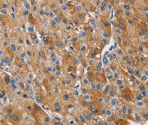 Anti-Human KLK1 Antibody - ABMIUM