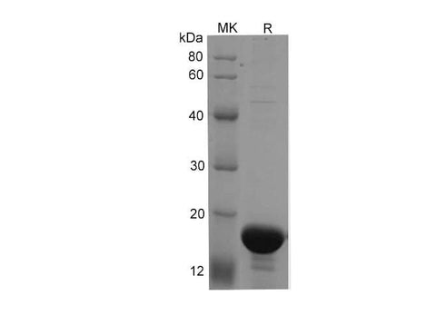 SDS-PAGE analysis of Human ACE2 (596K-740S) proteins, 2 μg/lane of Recombinant Human ACE2 (596K-740S) proteins was resolved with SDS-PAGE under reducing conditions, showing bands at 15-18 kDa.