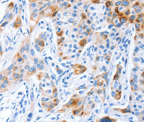 Anti-Human/Mouse PROM1 Antibody - ABMIUM