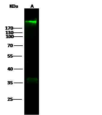 Anti-Human FN1 Antibody [B240] - ABMIUM