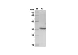SDS-PAGE analysis of Rat IL-4 proteins, 2 μg/lane of Recombinant Rat IL-4 proteins was resolved with SDS-PAGE under reducing conditions, showing bands at 33 kDa.