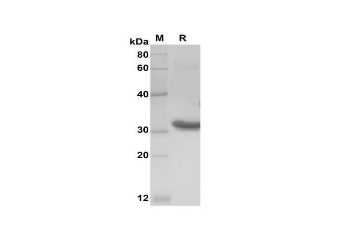 SDS-PAGE analysis of Rat IL-4 proteins, 2 μg/lane of Recombinant Rat IL-4 proteins was resolved with SDS-PAGE under reducing conditions, showing bands at 33 kDa.