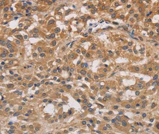 Anti-Human/Mouse/Rat DSTN Antibody