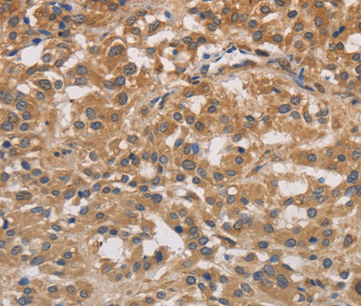 Anti-Human/Mouse/Rat DSTN Antibody - ABMIUM