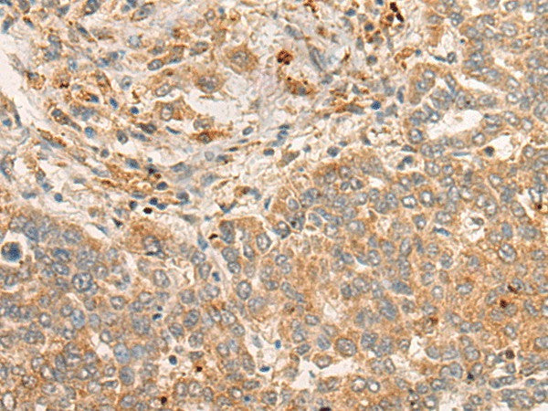 Anti-Human/Mouse/Rat FBXO32 Antibody - ABMIUM