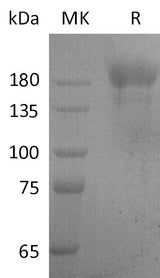 Recombinant SARS-CoV S-trimer Protein (C-6His) - ABMIUM