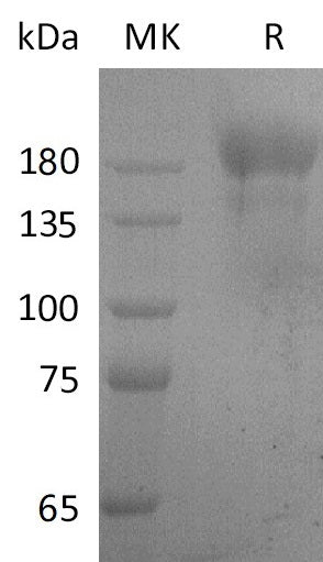 Recombinant SARS-CoV S-trimer Protein (C-6His) - ABMIUM