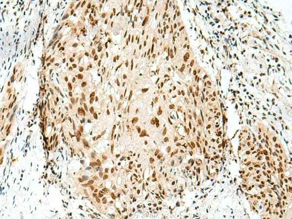 Anti-Human/Mouse/Rat RBM10 Antibody