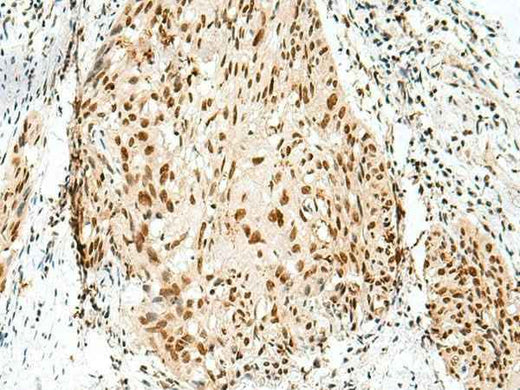 Anti-Human/Mouse/Rat RBM10 Antibody