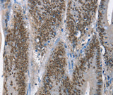 Anti-Human GNRH1 Antibody - ABMIUM
