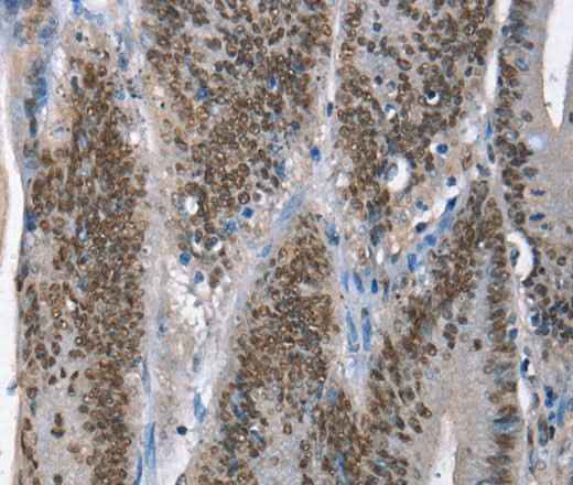Anti-Human GNRH1 Antibody