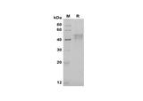 SDS-PAGE analysis of Human Pentraxin 3/TSG-14 proteins, 2 μg/lane of Recombinant Human Pentraxin 3/TSG-14 proteins was resolved with SDS-PAGE under reducing conditions, showing bands at 45 kDa.