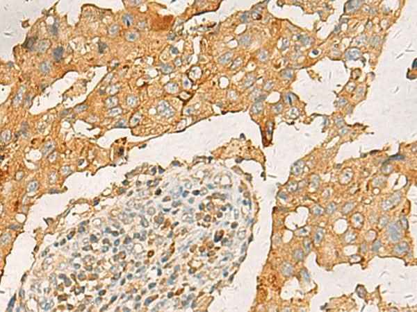 Anti-Human/Mouse/Rat CXCL1 Antibody