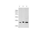 Anti-Human CTSB Antibody - ABMIUM