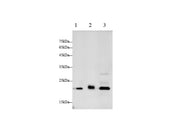 Anti-Human CTSB Antibody - ABMIUM