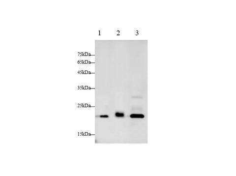 Anti-Human CTSB Antibody - ABMIUM