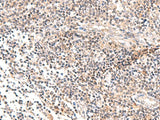 Immunohistochemistry of paraffin-embedded Human tonsil tissue using IL36B Polyclonal Antibody at dilution of 1:40(×200)
