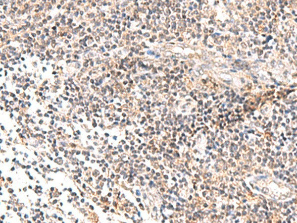 Immunohistochemistry of paraffin-embedded Human tonsil tissue using IL36B Polyclonal Antibody at dilution of 1:40(×200)