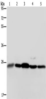 Anti-Human/Mouse/Rat HMGB1 Antibody - ABMIUM