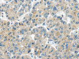 Anti-Human/Mouse/Rat MASP2 Antibody - ABMIUM