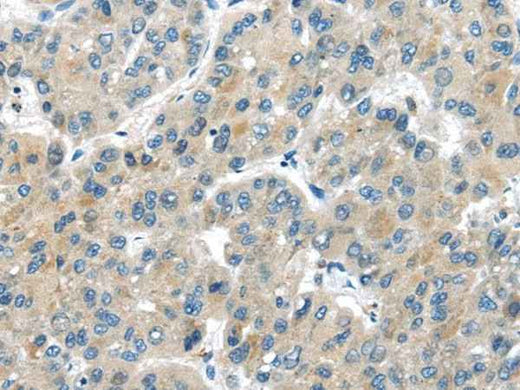 Anti-Human/Mouse/Rat MASP2 Antibody