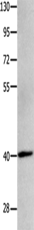 Anti-Human MAGEB4 Antibody - ABMIUM