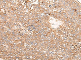 Anti-Human SIGLECL1 Antibody - ABMIUM