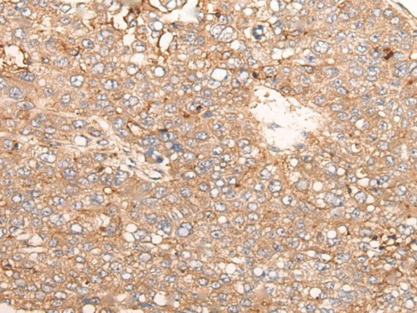 Anti-Human SIGLECL1 Antibody - ABMIUM