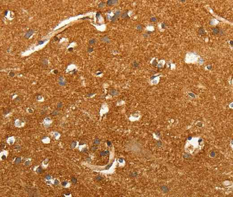 Anti-Human/Mouse/Rat SLC4A4 Antibody