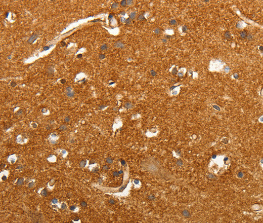 Anti-Human/Mouse/Rat SLC4A4 Antibody - ABMIUM