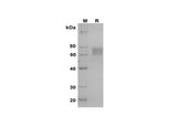 SDS-PAGE analysis of Mouse SerpinF2/SERPINF2 proteins, 2 μg/lane of Recombinant Mouse SerpinF2/SERPINF2 proteins was resolved with SDS-PAGE under reducing conditions, showing bands at 60-80 kDa.