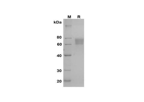 SDS-PAGE analysis of Mouse SerpinF2/SERPINF2 proteins, 2 μg/lane of Recombinant Mouse SerpinF2/SERPINF2 proteins was resolved with SDS-PAGE under reducing conditions, showing bands at 60-80 kDa.