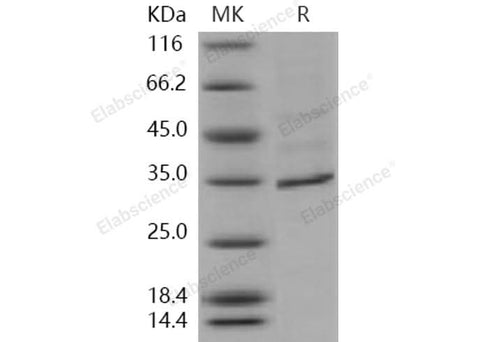 Recombinant Human FANCA/FACA Protein (His Tag) - ABMIUM