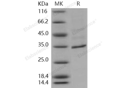Recombinant Human FANCA/FACA Protein (His Tag) - ABMIUM
