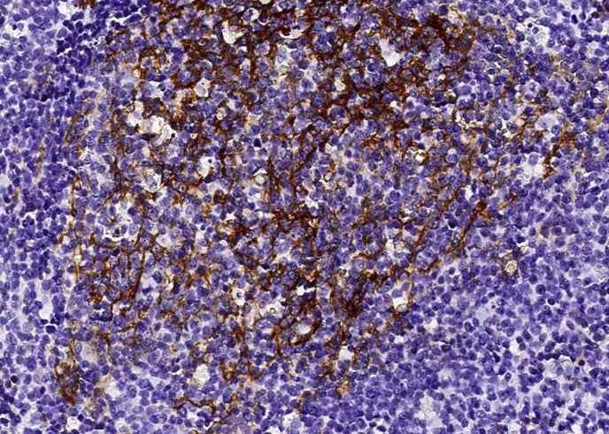 Anti-Human FCER2 Antibody [B233] - ABMIUM