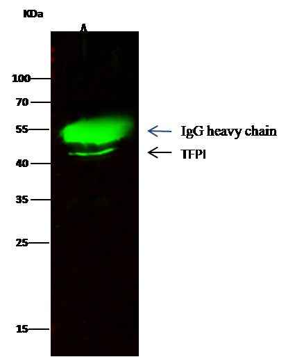 Anti-Human TFPI Antibody [B114] - ABMIUM