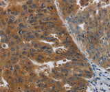 Anti-Human/Mouse/Rat PDCD2 Antibody - ABMIUM